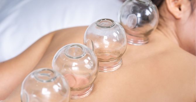 Cupping